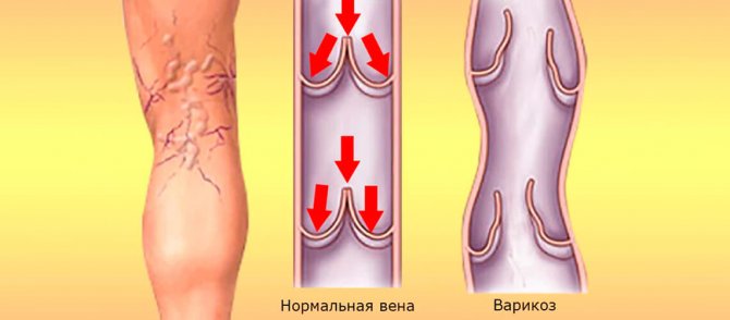 болезни 3