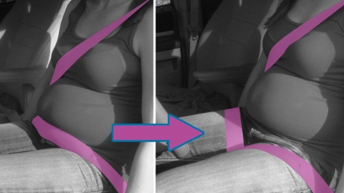 В США изобрели ремни безопасности для беременных женщин