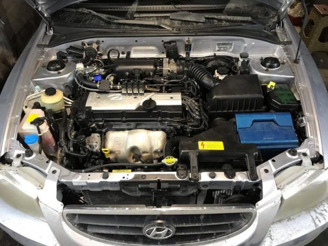 Подготовка к ремонту двигателя Hyundai